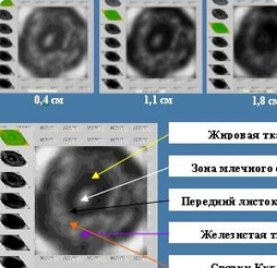 Маммограф МЭМ 20-08
