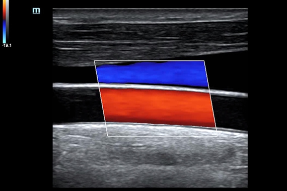 Mindray DC-70 pro X-Insight