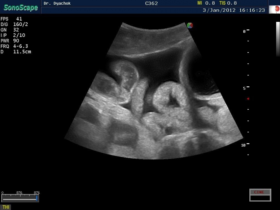 SonoScape S20Exp vet