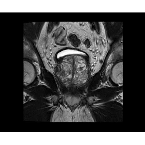 МРТ аппарат GE SIGNA Architect 3.0T