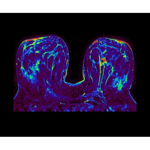 МРТ аппарат GE SIGNA Architect 3.0T