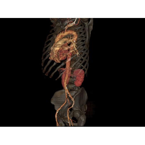 КТ аппарат GE Optima CT520