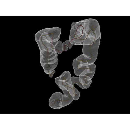 КТ аппарат GE Brivo CT385